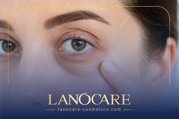 بررسی مشکلات رایج ناحیه دور چشم